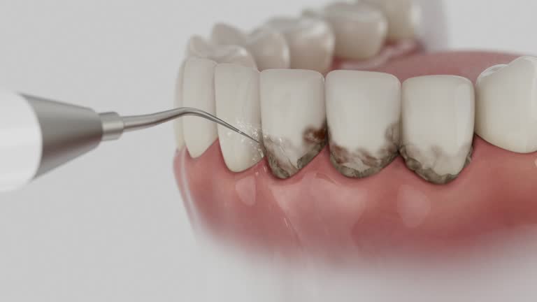 Trusted Root Canal Treatment service in Manhattan, NY - Dentist Open Now